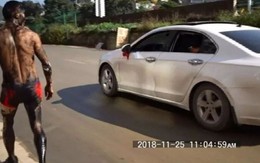 Chú rể vỡ sọ kiện bạn bè vì đùa quá trớn trong ngày cưới