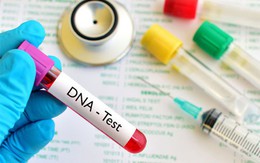 Con trai mua bộ thử ADN làm quà, phát hiện bí mật sốc của mẹ