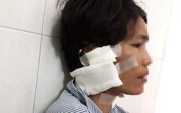 Thiếu phụ bị chồng cũ đâm dao vì không cho vay một triệu đồng