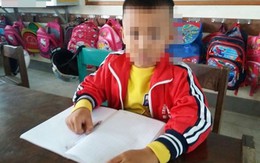 Cô giáo tát học sinh lớp 1 chảy máu tai: Không thể đổ lỗi cho áp lực