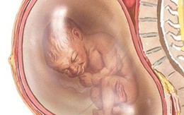 Tưởng đau bụng chuyển dạ đẻ, mẹ bầu 9 tháng sốc khi biết thai đã chết lưu