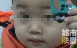 Bé trai 3 tuổi bị mù suốt 10 ngày chỉ vì bị cảm lạnh nhưng không điều trị dứt điểm