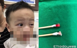 Bé trai dụi mắt đến mức chảy máu mắt, mẹ đưa đi khám phát hiện nguyên nhân do cha