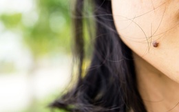 8 đặc điểm trên cơ thể tưởng vô dụng nhưng lại có ích