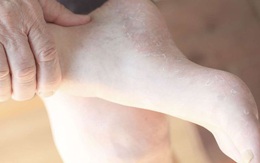 Bàn chân tiết lộ 10 dấu hiệu kín đáo của bệnh