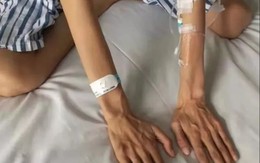 Hội chứng lạ khiến người phụ nữ có chân tay gầy, dài bất thường