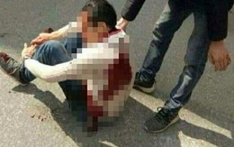 Nam thanh niên bị 2 đối tượng rượt đuổi, chém trọng thương trên phố bị nhiễm HIV