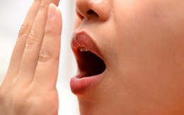 Viêm amidan có gây hôi miệng?