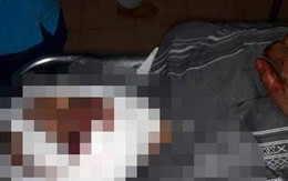 Xích mích trong làm ăn, một người bị đánh chết
