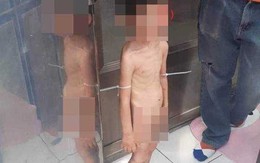 Phẫn nộ cậu bé 3 tuổi bị bố và người tình bạo hành mỗi ngày, đói tới mức phải lấy phân để ăn