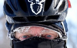 Bệnh viện Mỹ chật kín vì lạnh, hàng trăm người có thể mất tay chân