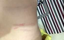 Vụ phụ huynh đòi bồi thường 100 triệu đồng: "Tôi không đưa sự việc này ra để làm tiền!"