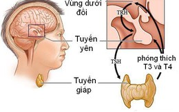 Những lý do khiến bạn không thể giảm cân