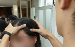 Hà Nội: Diễn biến bất ngờ vụ nữ sinh tố mẹ kế đánh chấn động não