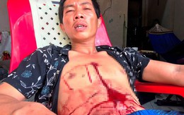 Thanh niên bị bắn vào ngực nhưng 'thà chết không đi bệnh viện'