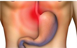 Căn bệnh khiến 7 triệu người khổ sở về đêm