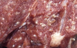 Nghi vấn thịt nhiễm sán tại trường mầm non: Nếu ăn phải thịt nhiễm sán, nguy hiểm cỡ nào?