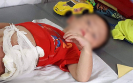 Bé trai 5 tuổi bị cậu ném vào đống lửa vì tranh nhau quả dưa chuột