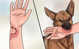 Sáu học sinh tiểu học bị chó cắn trong sân trường