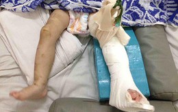 Xin bé 1 tuổi về nuôi rồi đánh gãy chân