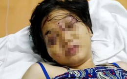 Lời khai của nhóm người tra tấn khiến cô gái 18 tuổi sẩy thai