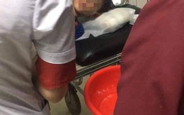 Sơn La: Bé trai 11 tuổi bị chó cắn nhập viện, 3 tháng sau tử vong