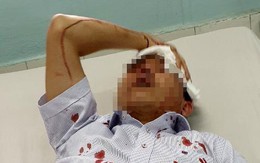 Đậu ôtô trước chung cư, 2 người bị nhóm côn đồ đánh nhập viện