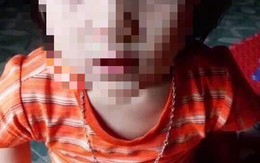Thái Nguyên: Nghi án bé gái 5 tuổi bị cô giáo nhét chất bẩn vào vùng kín