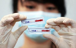 10 người nghi bị phơi nhiễm HIV do người lạ đâm: Bác sĩ khuyến cáo không nên quá hoảng hốt