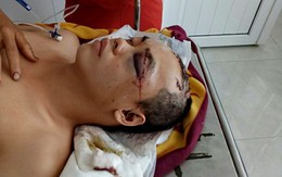 Truy lùng hung thủ chém người, cướp tài sản giữa ban ngày