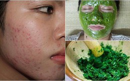 Mặt rỗ như tổ ong bầu cũng được lấp đầy nếu bạn làm việc này mỗi tối