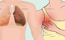 4 lời "báo động" từ cơ thể cảnh báo tế bào ung thư đang tấn công, sức đề kháng giảm sút