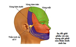 Bác sĩ hướng dẫn xử trí khi bị đau giật mặt