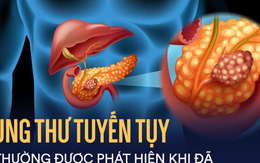 Căn bệnh ung thư cực kỳ nguy hiểm, tỷ lệ sống chỉ được 5%: Dấu hiệu nào nhận biết bệnh?