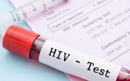 Xét nghiệm chẩn đoán HIV