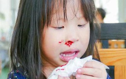 Từ vụ cháu bé nhập viện vì chảy máu cam ngày nắng nóng, cảnh báo điều cha mẹ cần làm để không hại con