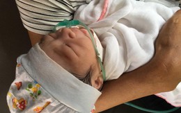 Yên Bái: Gia đình choáng váng khi bé sơ sinh vừa chào đời đã gãy xương đòn