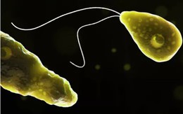 Đi bơi, tử vong vì nhiễm khuẩn "ăn não"