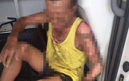 Nam Định: Con trai tưới xăng châm lửa đốt khiến bản thân tử vong, bố nhập viện cấp cứu