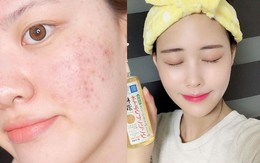 Chị em bỏ công sức, chi cả triệu bạc để chăm sóc da nhưng không biết điều tối thiểu này thì cũng đi tong hết