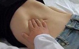 Nặn mụn ở ngực, nữ sinh 20 tuổi khiến bác sĩ giật mình khi nhìn thấy "vòng một"