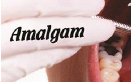 Amalgam – loại chất công ty Rạng Đông sử dụng thay thế thủy ngân thực chất là gì và có nguy hại không?