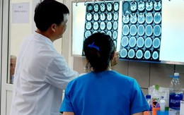 Ca đầu tiên ở Việt Nam bị xuất huyết não sau khi "chơi" ma tuý đá