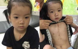 Không có tiền phẫu thuật tim, bé gái 4 tuổi có nguy cơ mất đi sự sống