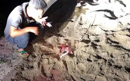 Hưng Yên: Bé trai 7 tuổi bị gần chục con chó dữ tấn công