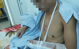 Nam Định: Chậm trả tiền lãi, một nam thanh niên bị đánh nhập viện