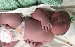Vừa chào đời, bé trai Hà Nội to bằng trẻ 3 tháng