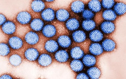 Xử trí trường hợp tiêu chảy do Rotavirus