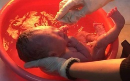 Vụ bé sơ sinh còn nguyên dây rốn được phát hiện trong thùng rác: Người mẹ tâm thần đã nhận con