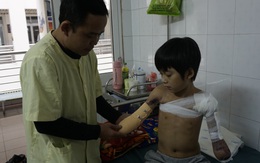 Cậu bé cụt hai tay sau điện giật Nguyễn Nhật Long phải ăn Tết ở bệnh viện